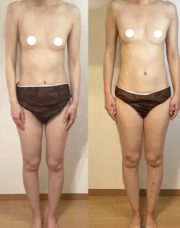 ビフォーアフター写真