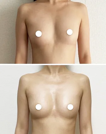 ビフォーアフター写真