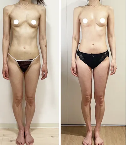 ビフォーアフター写真