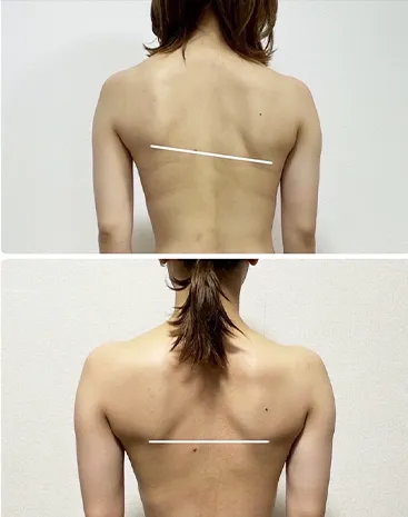 ビフォーアフター写真