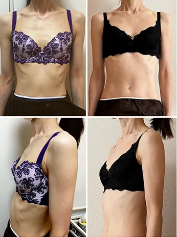 ビフォーアフター写真