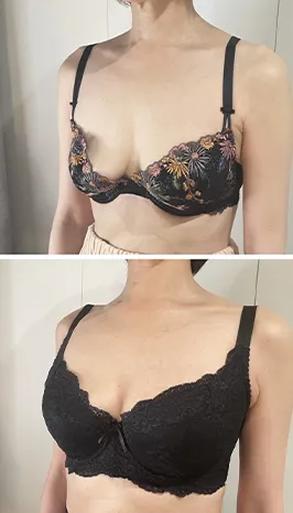 ビフォーアフター写真