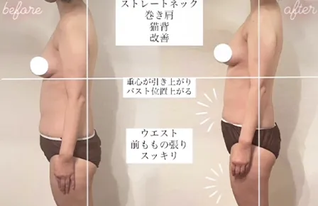 ビフォーアフター写真